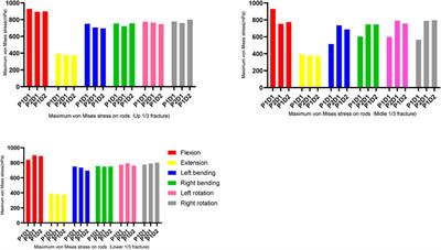 Finite element study of sagittal fracture location on thoracolumbar fracture treatment